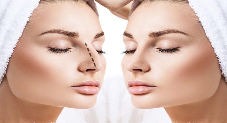 Which Type of Rhinoplasty Procedure Is the Perfect One for You