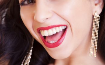 Are Dental Implants Right for You