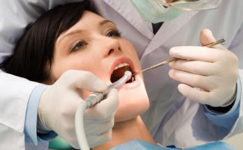 What to Expect Before, During, and After Wisdom Teeth Surgery